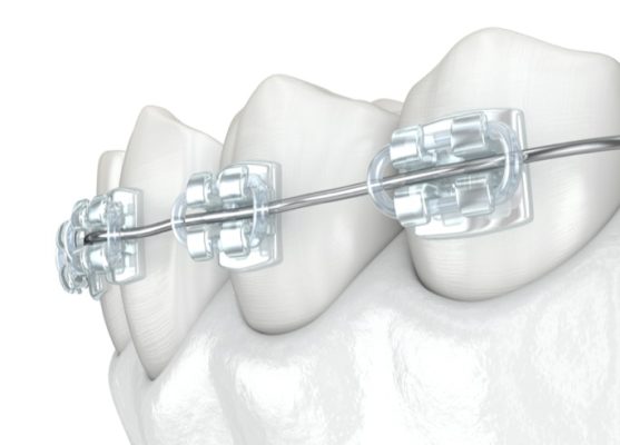 ortodoncja-1